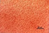 5 - Cellule corticali in visione superficiale